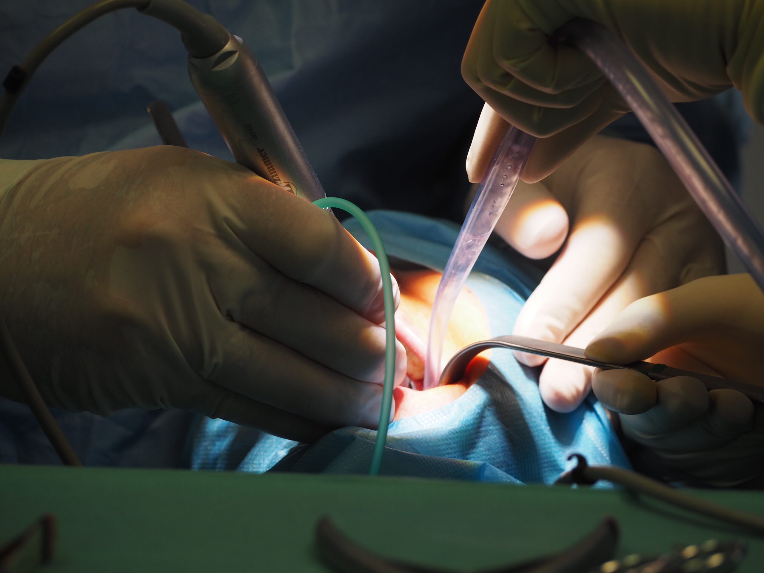 Chirurgie dentaire ght gpne