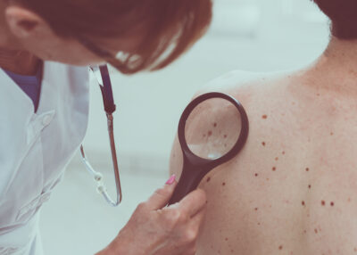 Dermatologie