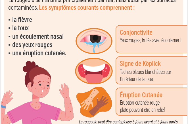 Information – Epidémie de Rougeole